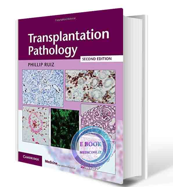 دانلود کتاب Transplantation Pathology Hardback with Online Resource 2nd 2021 ( PDF)